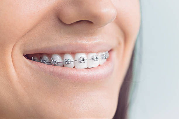 Best Full Mouth Reconstruction  in New London, TX